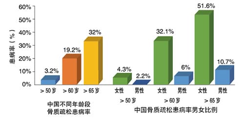 女性骨質數(shù)據(jù)